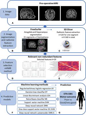 Radiomic features of amygdala nuclei and hippocampus subfields help to predict subthalamic deep brain stimulation motor outcomes for Parkinson‘s disease patients